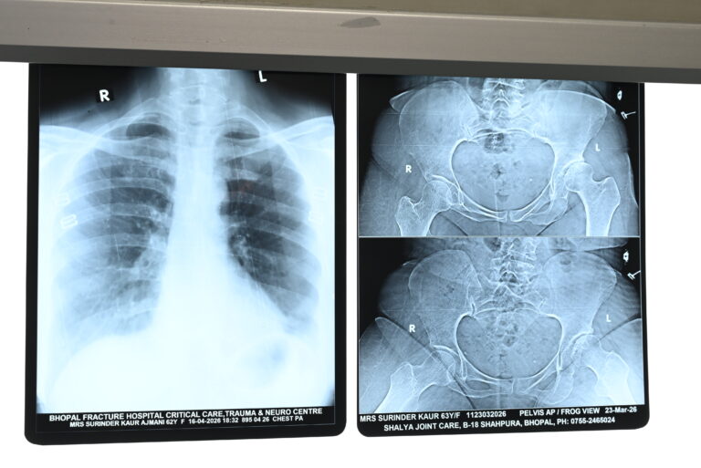 Healthy Lifestyle Tips for Strong Bones and Joints
